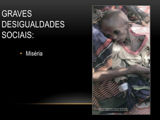 GRAVES
DESIGUALDADES
SOCIAIS:
• Miséria
 