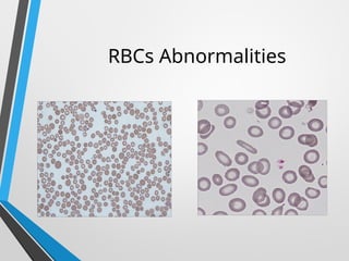 Peripheral blood smear pathology........... | PPTX
