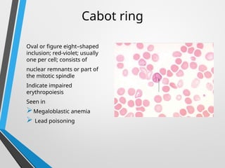 Peripheral blood smear pathology........... | PPTX
