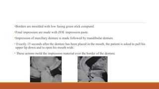 •Borders are moulded with low fusing green stick compund.
•Final impression are made with ZOE impression paste.
•Impression of maxillary denture is made followed by mandibular denture.
• Exactly 15 seconds after the denture has been placed in the mouth, the patient is asked to pull his
upper lip down and to open his mouth wide.
• These actions mold the impression material over the border of the denture.
 