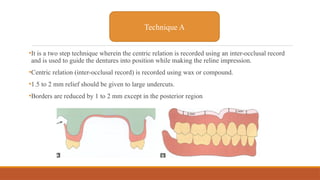 •It is a two step technique wherein the centric relation is recorded using an inter-occlusal record
and is used to guide the dentures into position while making the reline impression.
•Centric relation (inter-occlusal record) is recorded using wax or compound.
•1.5 to 2 mm relief should be given to large undercuts.
•Borders are reduced by 1 to 2 mm except in the posterior region
Technique A
 