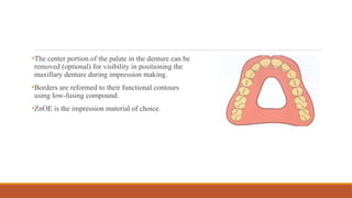 •The center portion of the palate in the denture can be
removed (optional) for visibility in positioning the
maxillary denture during impression making.
•Borders are reformed to their functional contours
using low-fusing compound.
•ZnOE is the impression material of choice.
 