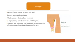 •Existing centric relation record is used here.
•Denture is prepared techniques.
•The borders are shortened and made flat.
•A large opening is made in the mid palatal region.
•Adhesive tape is attached over the buccal and labial surfaces
of both dentures 2 mm above the denture borders.
Technique D
 