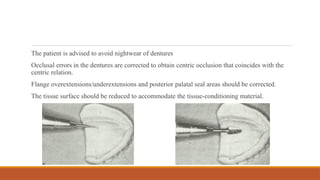 The patient is advised to avoid nightwear of dentures
Occlusal errors in the dentures are corrected to obtain centric occlusion that coincides with the
centric relation.
Flange overextensions/underextensions and posterior palatal seal areas should be corrected.
The tissue surface should be reduced to accommodate the tissue-conditioning material.
 