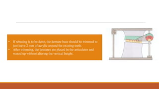 • If rebasing is to be done, the denture base should be trimmed to
just leave 2 mm of acrylic around the existing teeth.
• After trimming, the dentures are placed in the articulator and
waxed up without altering the vertical height.
 