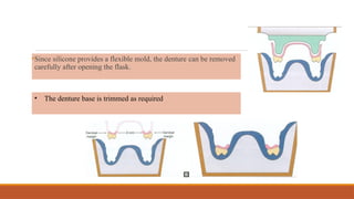 •Since silicone provides a flexible mold, the denture can be removed
carefully after opening the flask.
• The denture base is trimmed as required
 