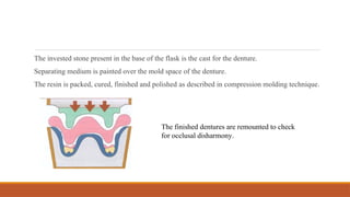 The invested stone present in the base of the flask is the cast for the denture.
Separating medium is painted over the mold space of the denture.
The resin is packed, cured, finished and polished as described in compression molding technique.
The finished dentures are remounted to check
for occlusal disharmony.
 