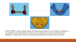 CONCLUSION - In this relining method, the impression procedure for a bar-retained overdenture is
accomplished with 2 ball abutments. It allows for recording the soft tissue beneath the bar and
replacing or modifying the retentive bar attachment simultaneously with the reline procedure.
 