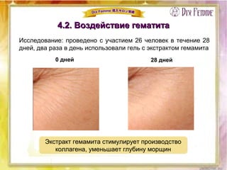 4.2. Воздействие гематита4.2. Воздействие гематита
Исследование: проведено с участием 26 человек в течение 28
дней, два раза в день использовали гель с экстрактом гемамита
0 дней 28 дней
Экстракт гемамита стимулирует производство
коллагена, уменьшает глубину морщин
Экстракт гемамита стимулирует производство
коллагена, уменьшает глубину морщин
 