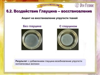 6.2. Воздействие Глауцина – восстановление6.2. Воздействие Глауцина – восстановление
Акцент на восстановление упругости тканейАкцент на восстановление упругости тканей
Без глауцина С глауцином
Результат: с добавлением глауцина возобновление упругости
коллагеновых волокон
 
