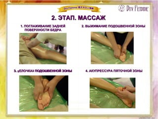 2. ЭТАП. МАССАЖ2. ЭТАП. МАССАЖ
1. ПОГЛАЖИВАНИЕ ЗАДНЕЙ1. ПОГЛАЖИВАНИЕ ЗАДНЕЙ
ПОВЕРХНОСТИ БЕДРАПОВЕРХНОСТИ БЕДРА
2. ВЫЖИМАНИЕ ПОДОШВЕННОЙ ЗОНЫ2. ВЫЖИМАНИЕ ПОДОШВЕННОЙ ЗОНЫ
3. „ЕЛОЧКА“ ПОДОШВЕННОЙ ЗОНЫ3. „ЕЛОЧКА“ ПОДОШВЕННОЙ ЗОНЫ 4. АКУПРЕССУРА ПЯТОЧНОЙ ЗОНЫ4. АКУПРЕССУРА ПЯТОЧНОЙ ЗОНЫ3. «ЕЛОЧКА» ПОДОШВЕННОЙ ЗОНЫ3. «ЕЛОЧКА» ПОДОШВЕННОЙ ЗОНЫ
 