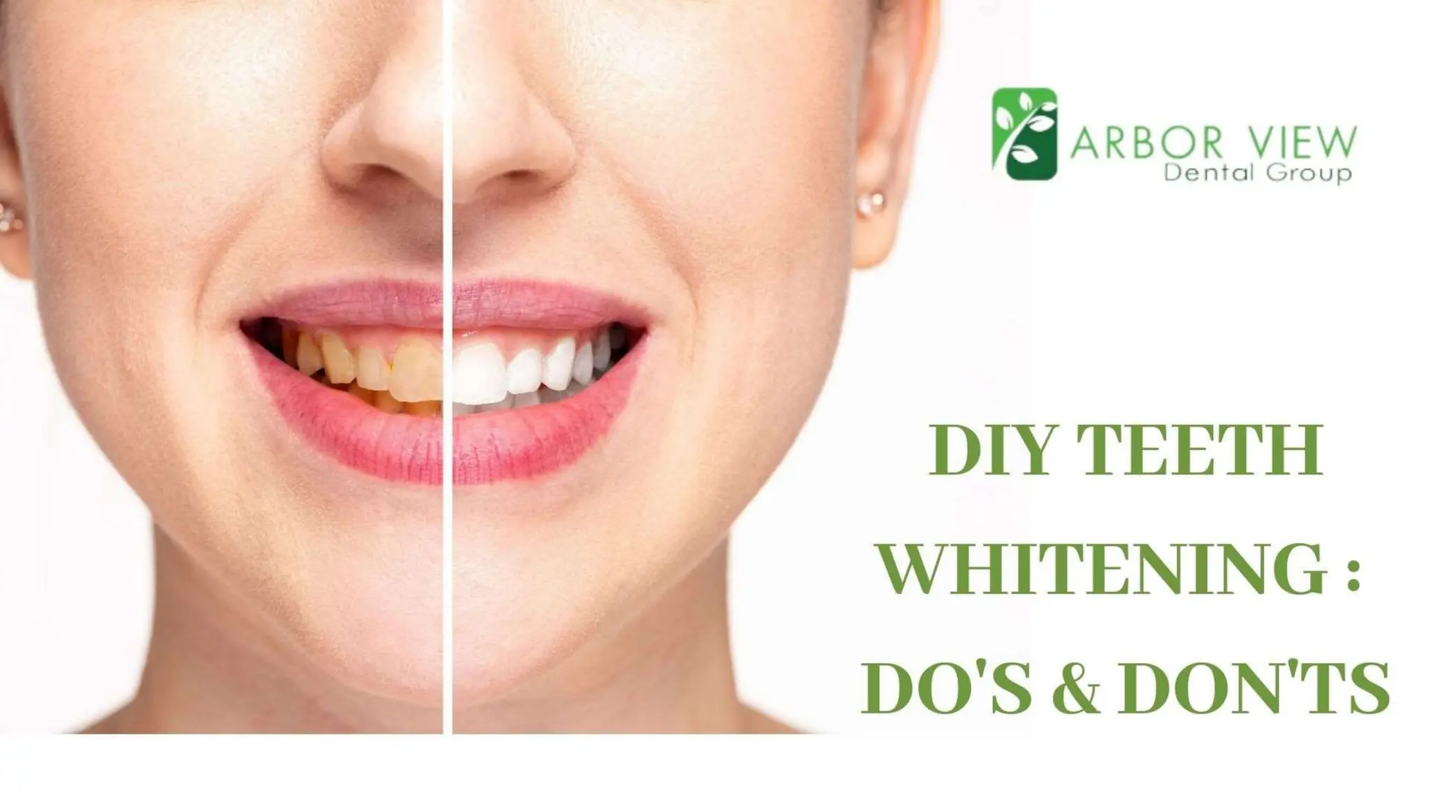 DIY Teeth Whitening Do's and Don'ts PPT