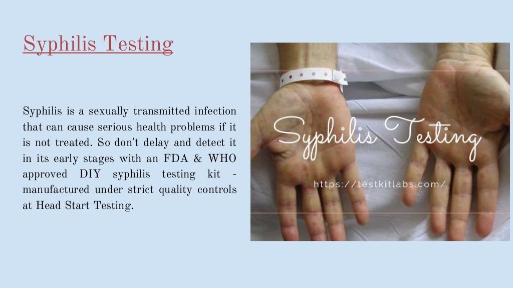 Diy Test For Chlamydia