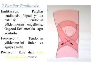 2.Patellar Tendinosis: 
Endikasyon: Patellar 
tendinosis, fatpad ya da 
patellar tendonun 
yüklenmesini engelleme, 
Osgood-Schlatter’da ağrı 
kontrolü 
Fonksiyon: Tendonun 
yüklenmesini önler ve 
ağrıyı azaltır. 
Pozisyon: Kişi dizi tam 
ekstansiyonda oturur. 
 