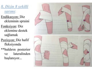 8. Dizin 8 şekilli 
sarımı: 
Endikasyon: Diz 
ekleminin spraini 
Fonksiyon: Diz 
eklemine destek 
sağlamak 
Pozisyon: Diz hafif 
fleksiyonda 
**baldırın posterior 
ve lateralinden 
başlanıyor... 
 