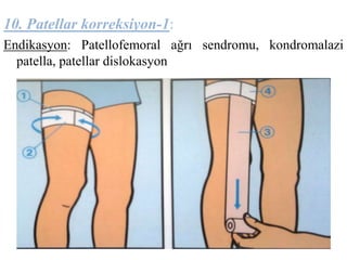 10. Patellar korreksiyon-1: 
Endikasyon: Patellofemoral ağrı sendromu, kondromalazi 
patella, patellar dislokasyon 
 