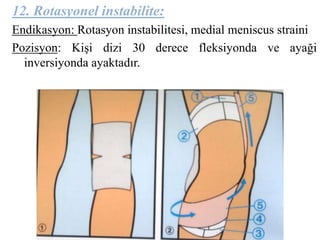 12. Rotasyonel instabilite: 
Endikasyon: Rotasyon instabilitesi, medial meniscus straini 
Pozisyon: Kişi dizi 30 derece fleksiyonda ve ayaği 
inversiyonda ayaktadır. 
 