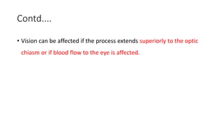 Contd....
• Vision can be affected if the process extends superiorly to the optic
chiasm or if blood flow to the eye is affected.
 