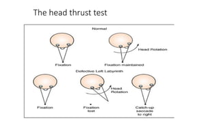 The head thrust test
 