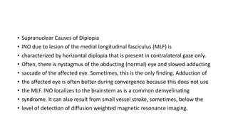 • Supranuclear Causes of Diplopia
• INO due to lesion of the medial longitudinal fasciculus (MLF) is
• characterized by horizontal diplopia that is present in contralateral gaze only.
• Often, there is nystagmus of the abducting (normal) eye and slowed adducting
• saccade of the affected eye. Sometimes, this is the only finding. Adduction of
• the affected eye is often better during convergence because this does not use
• the MLF. INO localizes to the brainstem as is a common demyelinating
• syndrome. It can also result from small vessel stroke, sometimes, below the
• level of detection of diffusion weighted magnetic resonance imaging.
 