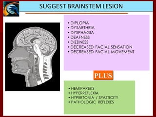 SUGGEST BRAINSTEM LESION
• DIPLOPIA
• DYSARTHRIA
• DYSPHAGIA
• DEAFNESS
• DIZZINESS
• DECREASED FACIAL SENSATION
• DECREASED FACIAL MOVEMENT
PLUS
• HEMIPARESIS
• HYPERREFLEXIA
• HYPERTONIA / SPASTICITY
• PATHOLOGIC REFLEXES
 