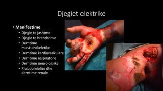 Djegiet elektrike
• Manifestime
• Djegie te jashtme
• Djegie te brendshme
• Demtime
muskuloskeletike
• Demtime kardiovaskulare
• Demtime respiratore
• Demtime neurologjike
• Rrabdomiolize dhe
demtime renale
 