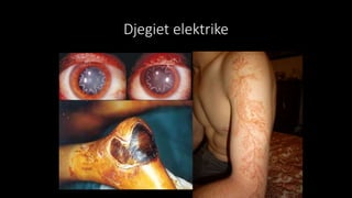 Djegiet elektrike
 