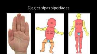 Djegiet sipas siperfaqes
 