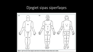 Djegiet sipas siperfaqes
 