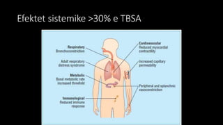 Efektet sistemike >30% e TBSA
 