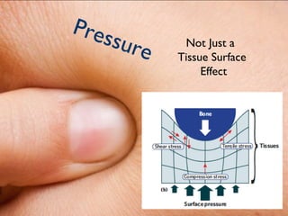 Pres
    s   ure    Not Just a
              Tissue Surface
                   Effect
 