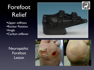 Forefoot
 Relief
•Upper stiffness
•Rocker Position
•Angle
•Carbon stiffener


 Neuropathic
  Forefoot
   Lesion
 