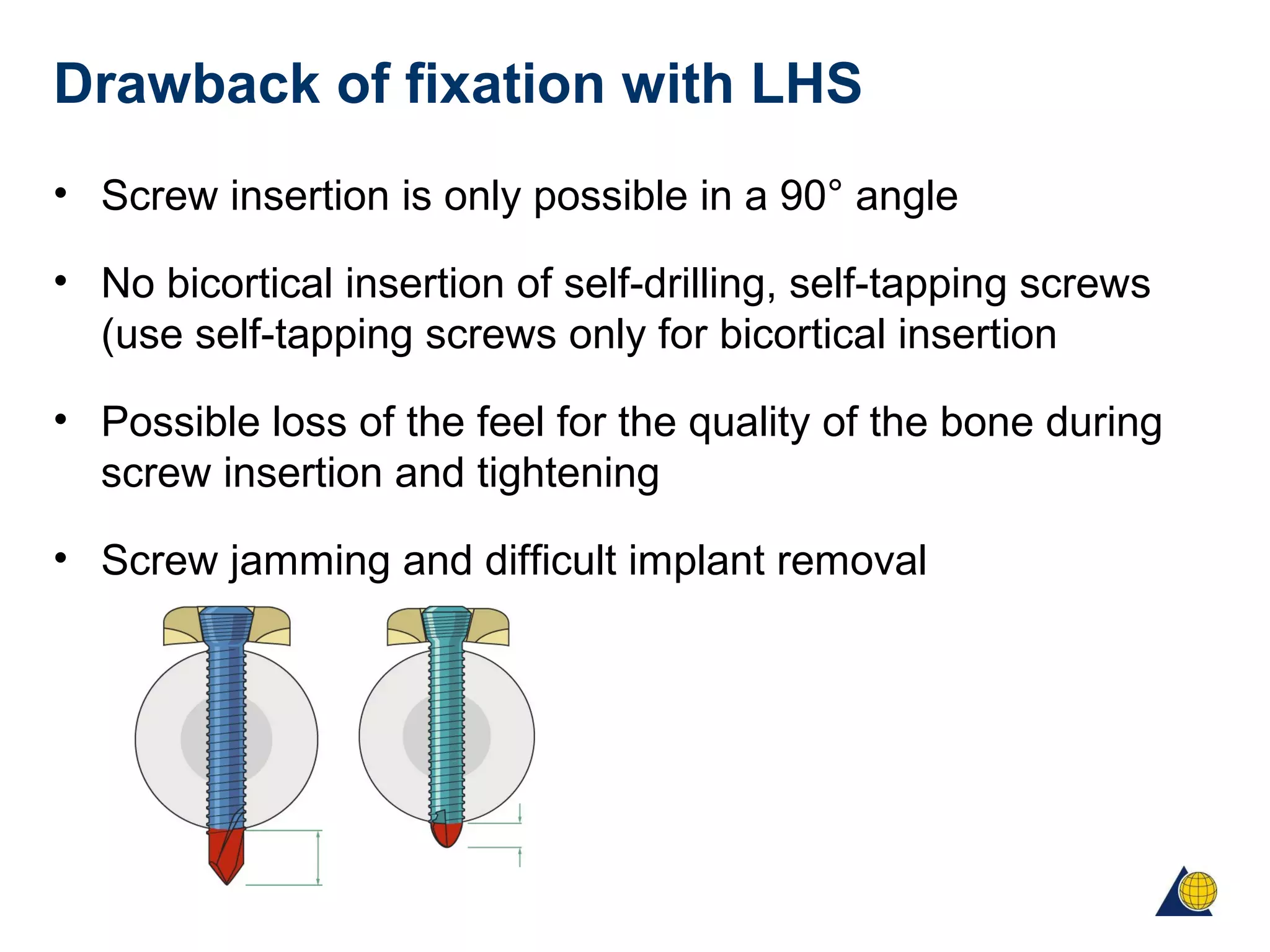 Drawback of fixation with LHS
• Screw insertion is only possible in a 90° angle
• No bicortical insertion of self-drilling, self-tapping screws
(use self-tapping screws only for bicortical insertion
• Possible loss of the feel for the quality of the bone during
screw insertion and tightening
• Screw jamming and difficult implant removal
 