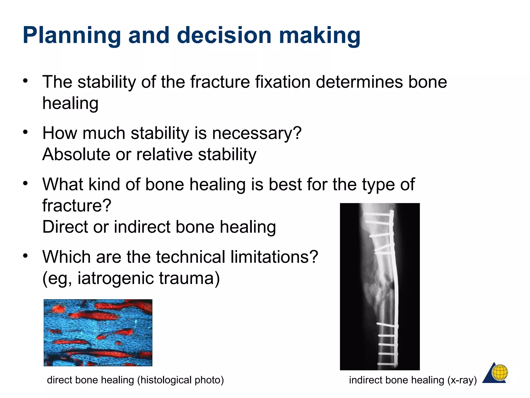 Planning and decision making
• The stability of the fracture fixation determines bone
healing
• How much stability is necessary?
Absolute or relative stability
• What kind of bone healing is best for the type of
fracture?
Direct or indirect bone healing
• Which are the technical limitations?
(eg, iatrogenic trauma)
direct bone healing (histological photo) indirect bone healing (x-ray)
 