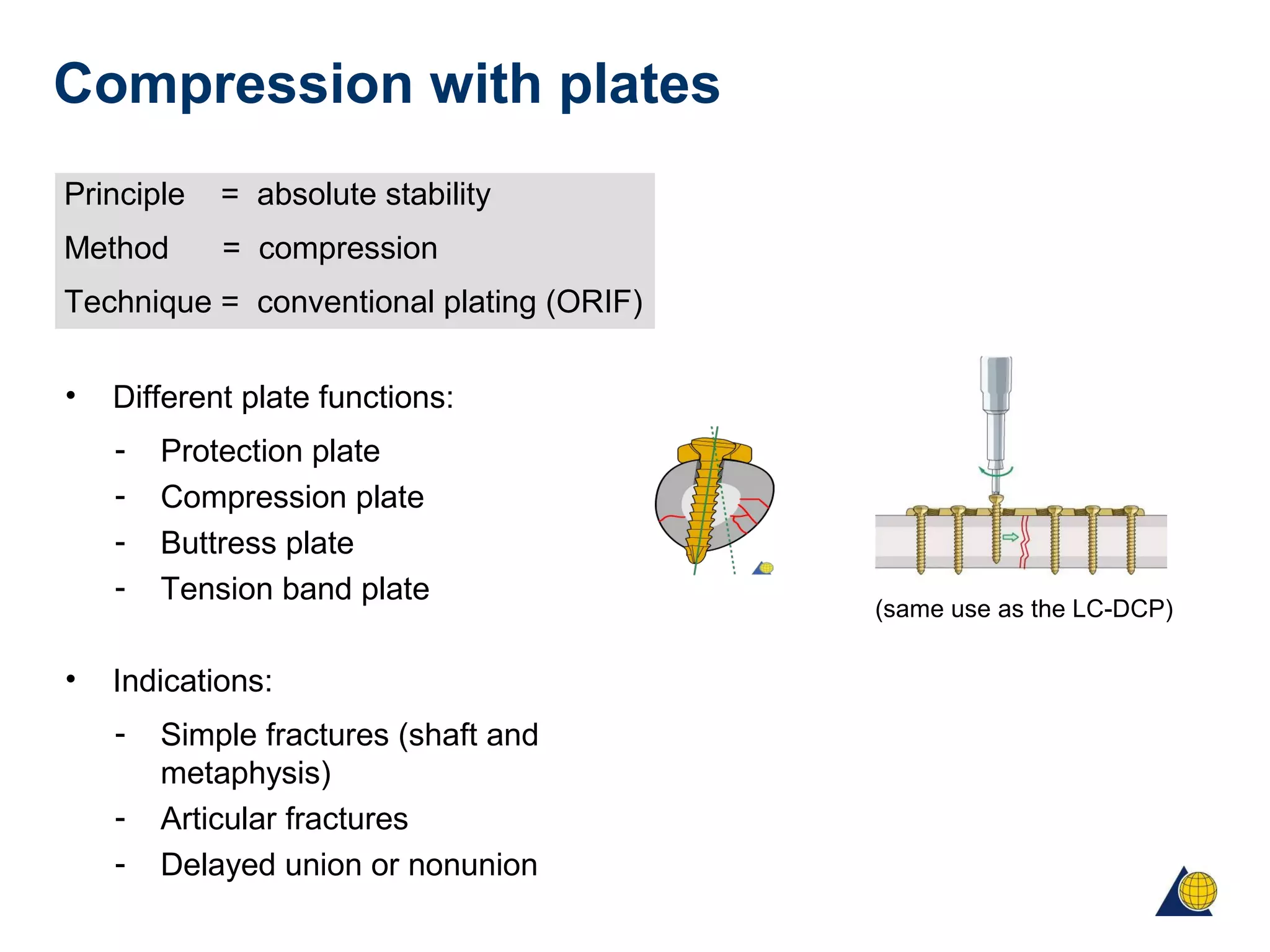 Compression with plates
Principle = absolute stability
Method = compression
Technique = conventional plating (ORIF)
• Different plate functions:
- Protection plate
- Compression plate
- Buttress plate
- Tension band plate
• Indications:
- Simple fractures (shaft and
metaphysis)
- Articular fractures
- Delayed union or nonunion
(same use as the LC-DCP)
 
