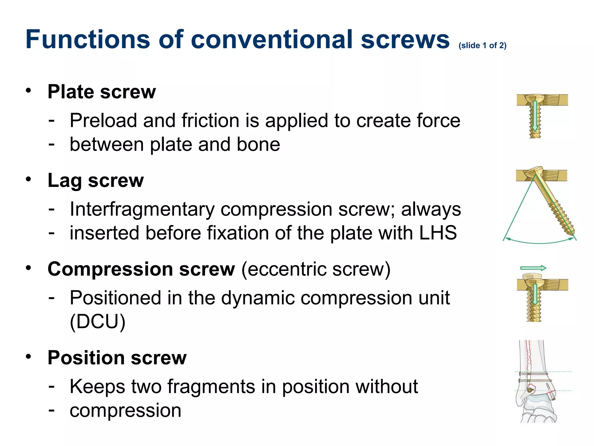 Functions of conventional screws (slide 1 of 2)
• Plate screw
- Preload and friction is applied to create force
- between plate and bone
• Lag screw
- Interfragmentary compression screw; always
- inserted before fixation of the plate with LHS
• Compression screw (eccentric screw)
- Positioned in the dynamic compression unit
(DCU)
• Position screw
- Keeps two fragments in position without
- compression
 