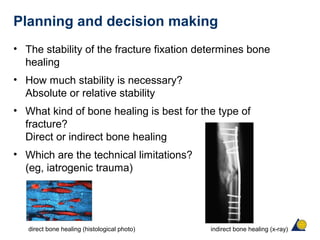 Planning and decision making
• The stability of the fracture fixation determines bone
healing
• How much stability is necessary?
Absolute or relative stability
• What kind of bone healing is best for the type of
fracture?
Direct or indirect bone healing
• Which are the technical limitations?
(eg, iatrogenic trauma)
direct bone healing (histological photo) indirect bone healing (x-ray)
 