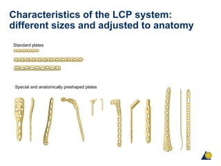 Characteristics of the LCP system:
different sizes and adjusted to anatomy
Standard plates
Special and anatomically preshaped plates
 