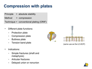 Compression with plates
Principle = absolute stability
Method = compression
Technique = conventional plating (ORIF)
• Different plate functions:
- Protection plate
- Compression plate
- Buttress plate
- Tension band plate
• Indications:
- Simple fractures (shaft and
metaphysis)
- Articular fractures
- Delayed union or nonunion
(same use as the LC-DCP)
 