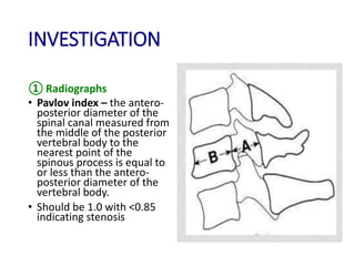 INVESTIGATION
① Radiographs
• Pavlov index – the antero-
posterior diameter of the
spinal canal measured from
the middle of the posterior
vertebral body to the
nearest point of the
spinous process is equal to
or less than the antero-
posterior diameter of the
vertebral body.
• Should be 1.0 with <0.85
indicating stenosis
 