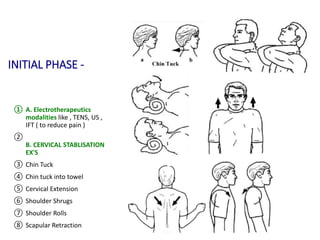 INITIAL PHASE -
① A. Electrotherapeutics
modalities like , TENS, US ,
IFT ( to reduce pain )
②
B. CERVICAL STABLISATION
EX'S
③ Chin Tuck
④ Chin tuck into towel
⑤ Cervical Extension
⑥ Shoulder Shrugs
⑦ Shoulder Rolls
⑧ Scapular Retraction
 