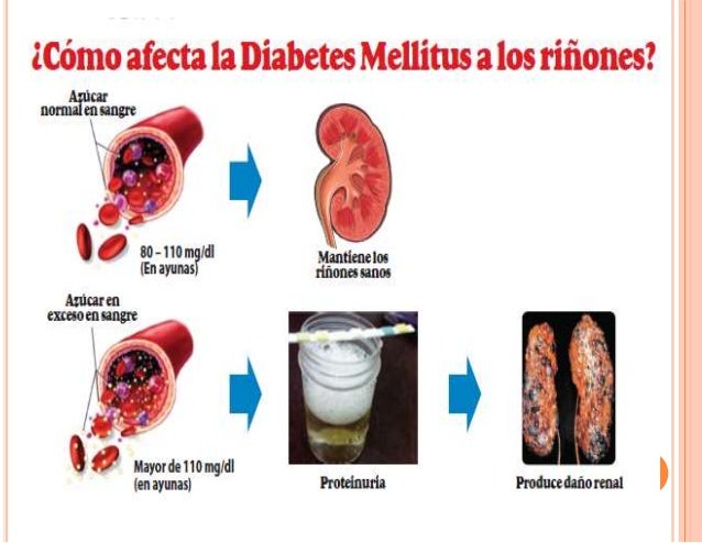 Complicaciones diabetes mellitus tipo 2 e hipertension arteria Complicaciones diabetes mellitus tipo 2 e hipertension arteria