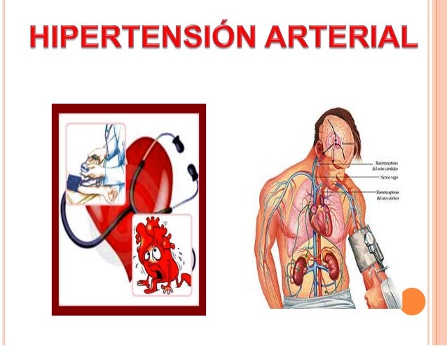 Metabolic syndrome: definition, history, criterion Complicaciones diabetes mellitus tipo 2 e hipertension arteria
