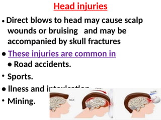 Head injuries
• Direct blows to head may cause scalp
wounds or bruising and may be
accompanied by skull fractures
• These injuries are common in
• Road accidents.
• Sports.
• llness and intoxication.
• Mining.
 