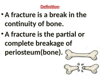 Definition:
• A fracture is a break in the
continuity of bone.
• A fracture is the partial or
complete breakage of
periosteum(bone).
 