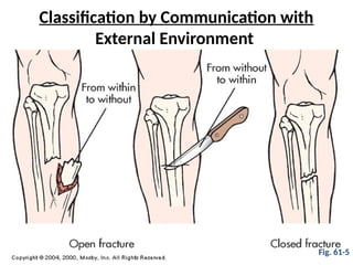 Classification by Communication with
External Environment
Fig. 61-5
 