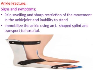 Ankle Fracture:
Signs and symptoms;
• Pain swelling and sharp restriction of the movement
in the anklejoint and inability to stand
• Immobilize the ankle using an L- shaped splint and
transport to hospital.
 