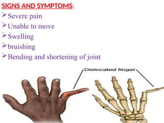 SIGNS AND SYMPTOMS:
Severe pain
Unable to move
Swelling
bruishing
Bending and shortening of joint
 