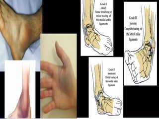first_aid_with_injuries_and_fracture..pptx