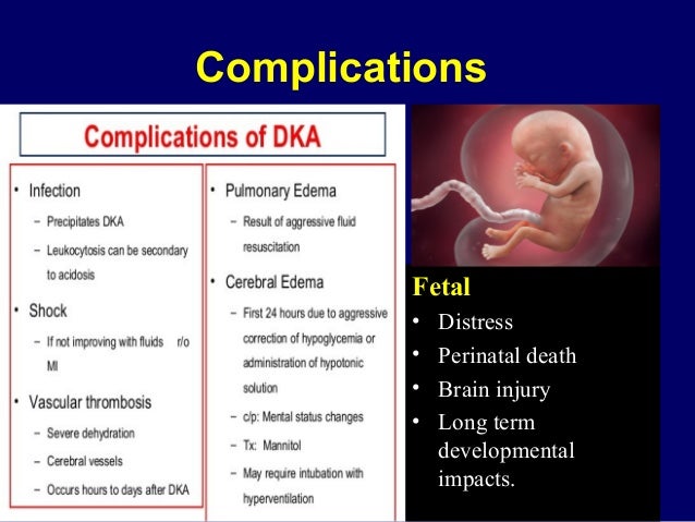 Detailed Guidelines for Treatment of Diabetic Ketoacidosis